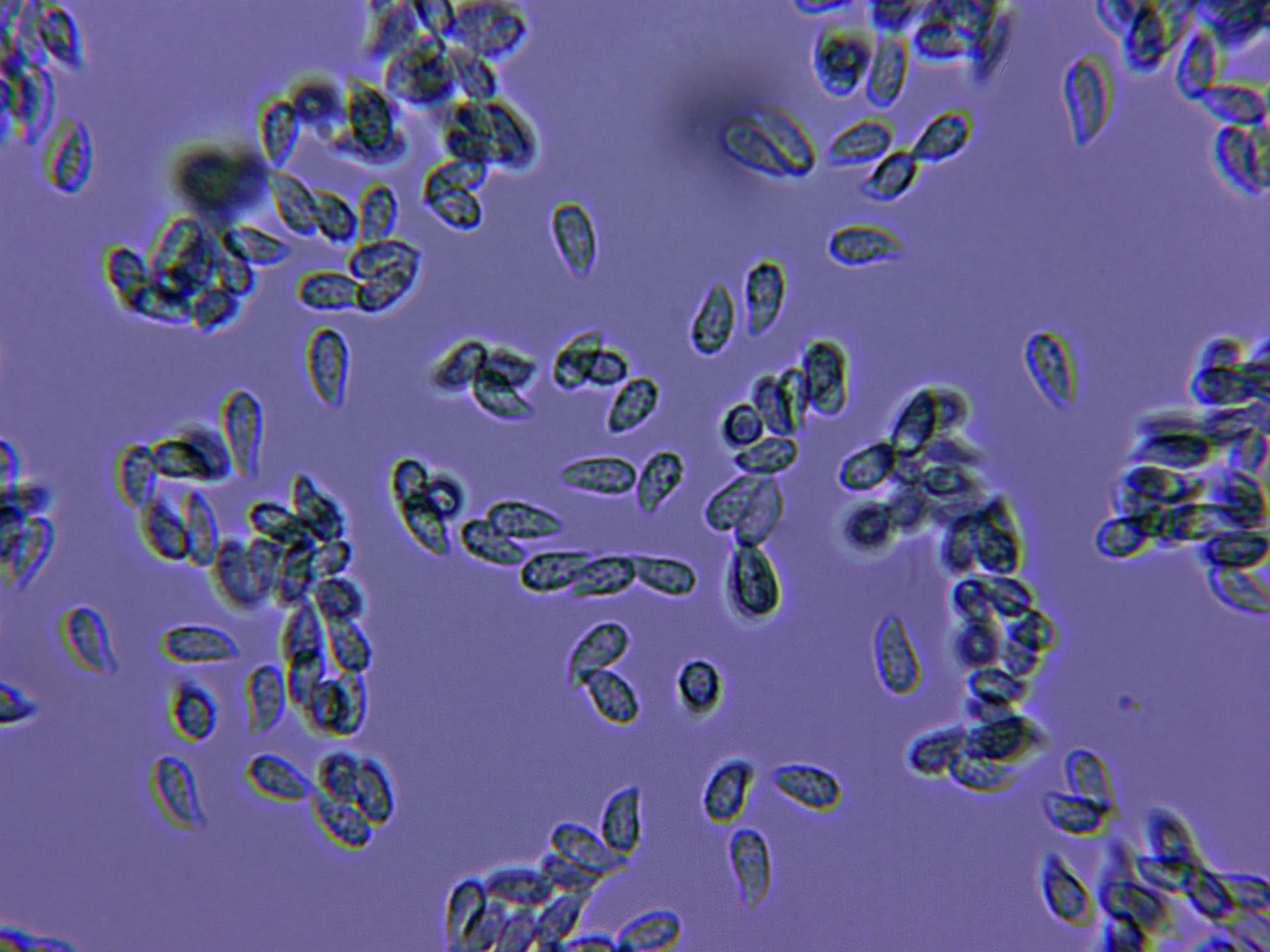 Microscopía de Phaeoclavulina abietina - 10 - Esporas azul de Lactofenol